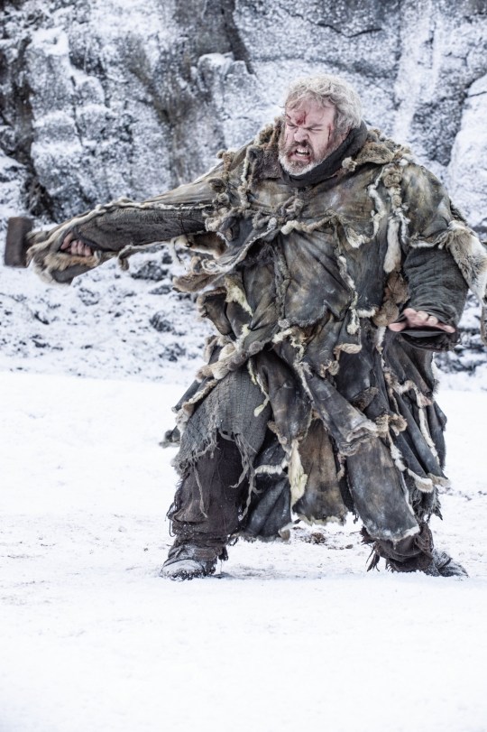 Kristian Nairn in Game of Thrones